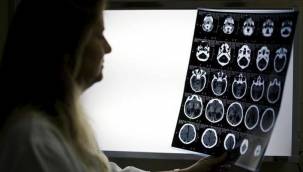 KANSER ARAŞTIRMASINDA UMUT VERİCİ GELİŞME